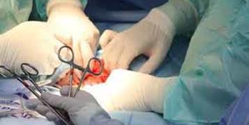 Screw of nose stud stuck in woman’s wind pipe removed without surgery at Pudukkottai medical college