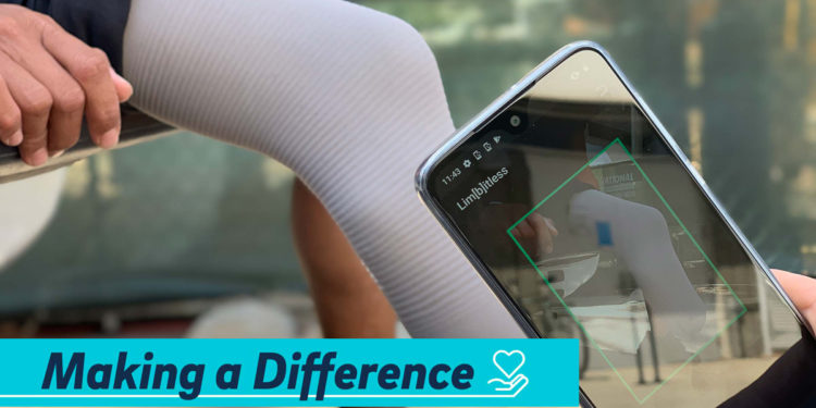 Lim(b)itless in India: UC San Diego students travel abroad to empower amputees