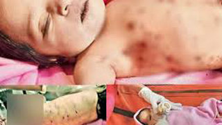 Save the babies: 3-day-old girl found with 20 stab wounds in Rajkot