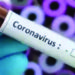 Coronavirus: Jagan reviews preventive measures