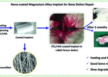 IIT-M Researchers develop Nano-Coated Magnesium Alloys to Repair Bone Fractures