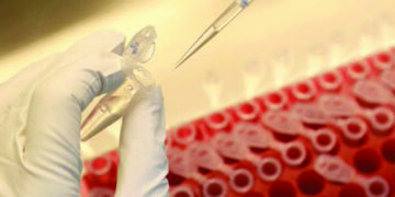 Indian-American-led research team wins $100,000 NIH prize for phone-based saliva test