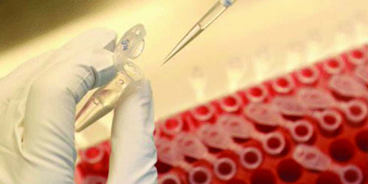 Indian-American-led research team wins $100,000 NIH prize for phone-based saliva test