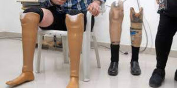 PM birthday: Jaipur Foot USA to organise state-level free artificial limb fitment camp in Gujarat