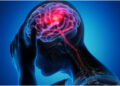 World Stroke Day: There is no benefit in treating dizziness without understanding the cause, especially in older people