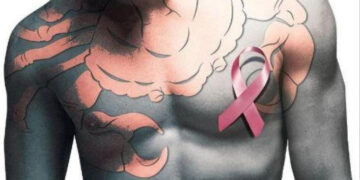 World Cancer Day: Breast cancer is gender neutral, say oncologists