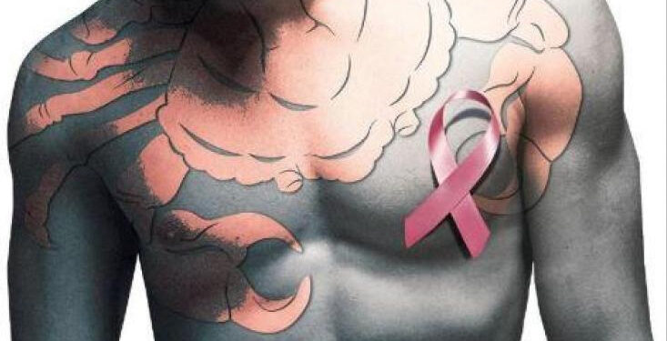 World Cancer Day: Breast cancer is gender neutral, say oncologists