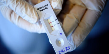 Apollo Hospitals, TataMD partner to launch ‘TataMD CHECK’ test for COVID-19