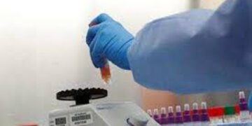 Zydus Cadila completes phase 2 clinical trial in COVID-19 patients with biological therapy PegiHep