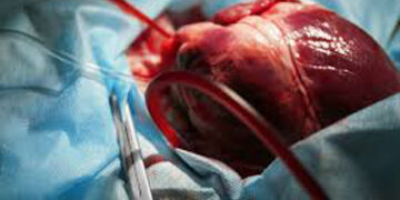 Organ transplantation: Heart flown in from Vadodara to Delhi