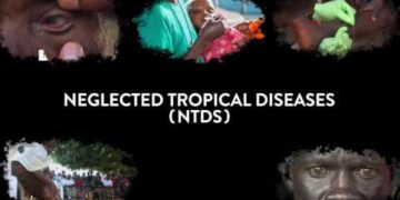 Ahead of WHO’s 2021-30 goal, Gujarat commits to eliminate Neglected Tropical Diseases