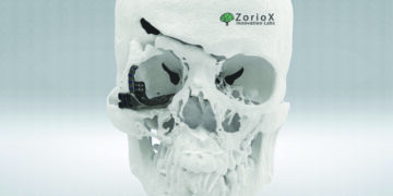 Chennai lab uses 3D technology to help restore beautiful faces