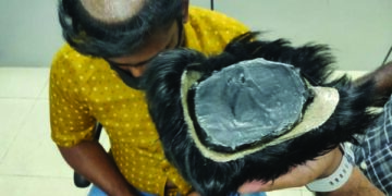 Gold worth Rs 2.53 crore concealed in wigs seized; 6 held in Chennai airport