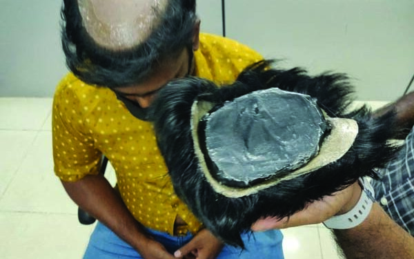 Gold worth Rs 2.53 crore concealed in wigs seized; 6 held in Chennai airport