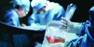 51-year-old brain dead man gives life to 8 people