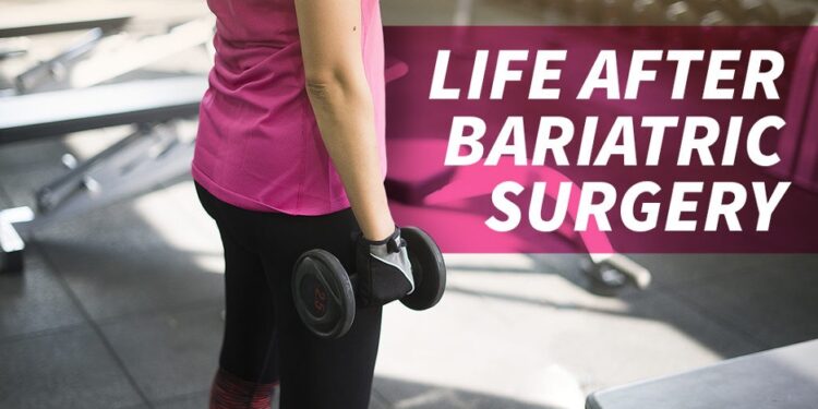 Life after Bariatric Surgery – What to Expect?