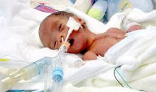 CIMS Hospital performs cardiac surgery  on 24-day-old girl weighing 700 gm