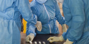 Over 80 pc Ahmedabad population has COVID-19 antibodies: Serological survey