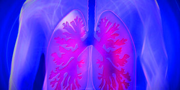 Lungs harvested in Ahmedabad, flown to Delhi, transplanted in man from Meerut