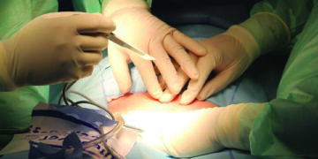 Doctors at Prashanth Hospitals successfully remove rare abdomen tumour from an 87-year-old woman