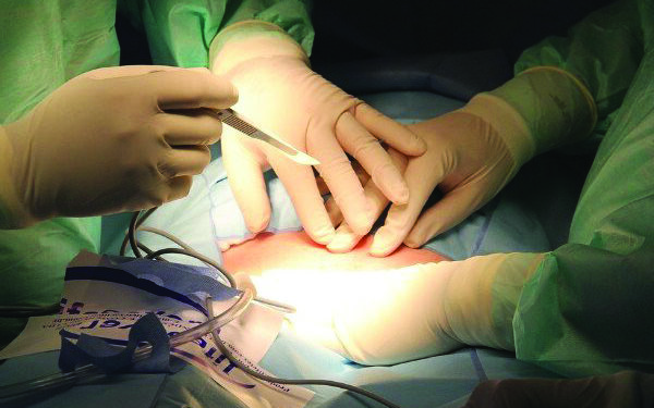 Doctors at Prashanth Hospitals successfully remove rare abdomen tumour from an 87-year-old woman