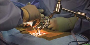 HCG Hospitals conducts spinal osteotomy procedure on 12-year-old congenital scoliosis patient