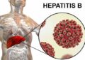 Hepatitis B and the Indian youth: Are we protected enough from serious liver diseases?