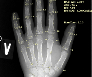 AI meets precision care: Aarthi Scans & Labs Deploys BoneXpert across 100 centres nationwide