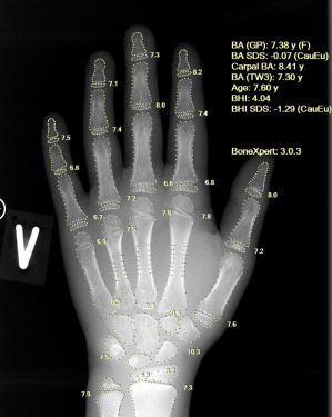 AI meets precision care: Aarthi Scans & Labs Deploys BoneXpert across 100 centres nationwide