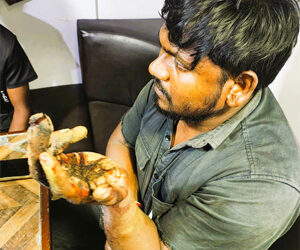 Guardians of the Sea: Indian Coast Guard executes life-saving medical evacuation off Veraval Coast