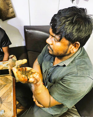 Guardians of the Sea: Indian Coast Guard executes life-saving medical evacuation off Veraval Coast