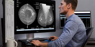 A new weapon against breast cancer: Apollo Spectra unveils AI-powered 3D screening that could save thousands of lives