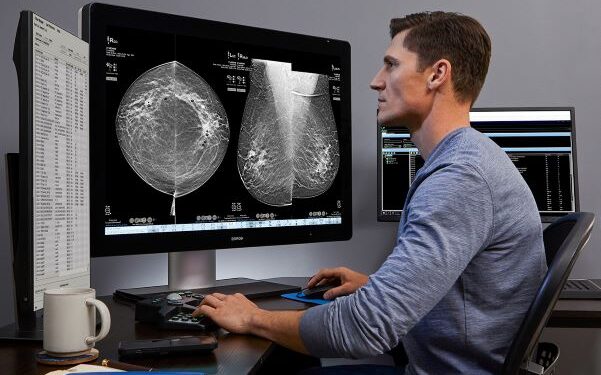 A new weapon against breast cancer: Apollo Spectra unveils AI-powered 3D screening that could save thousands of lives