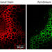 Lighting up the hidden highways of plants: IITGN scientists redefine xylem imaging